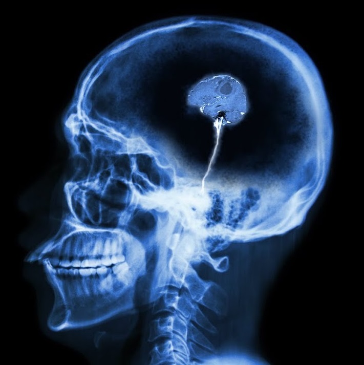 Ученые доказали — марихуана может «снести крышу»