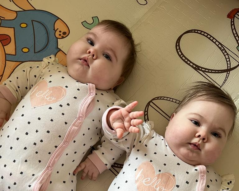 Двойняшкам Варе и Лере из Омска нужны деньги на лечение