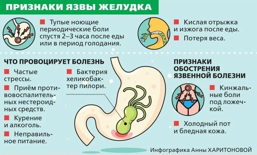 Признаки, которые позволят обнаружить язву желудка