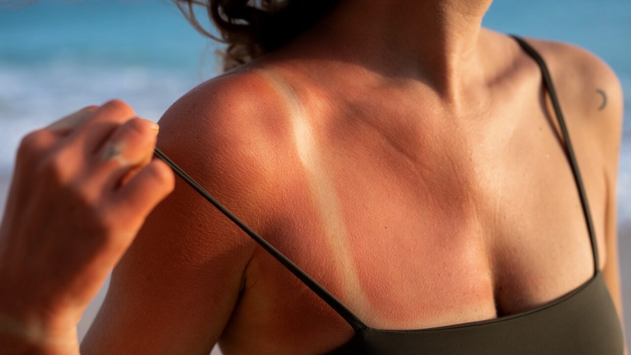 Как защитить кожу летом: 7 важных правил