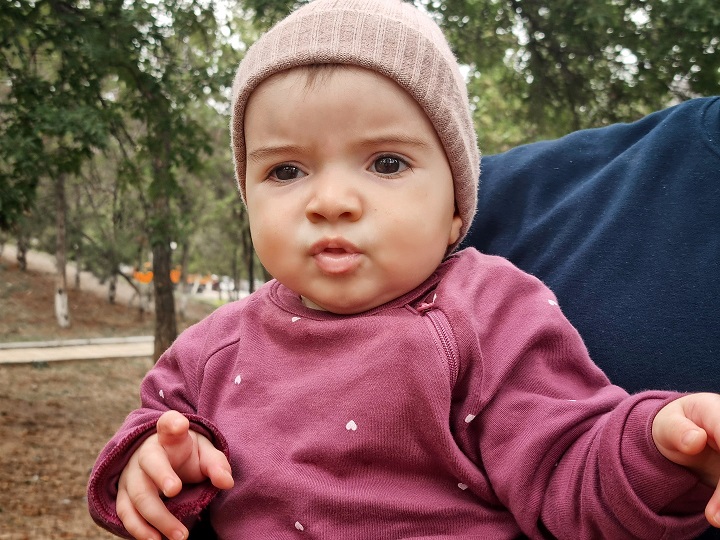 Малышка с редкой патологией черепа ждет спасительной операции