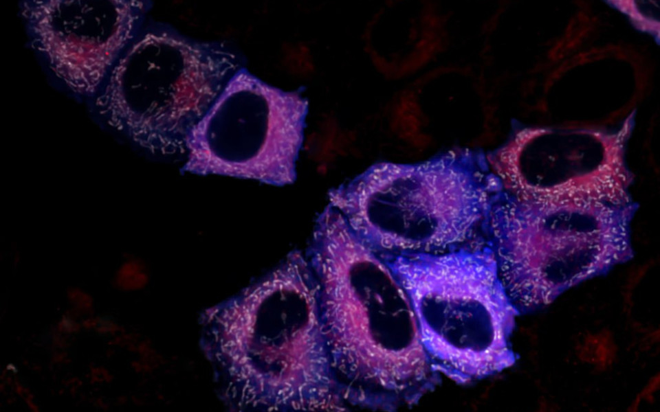 Ученые Пироговского Университета создали новый биосенсор для детекции пероксида водорода
