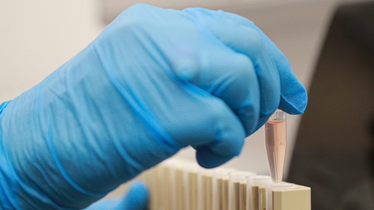 Профилактика диабета: советы по лечению от эндокринолога