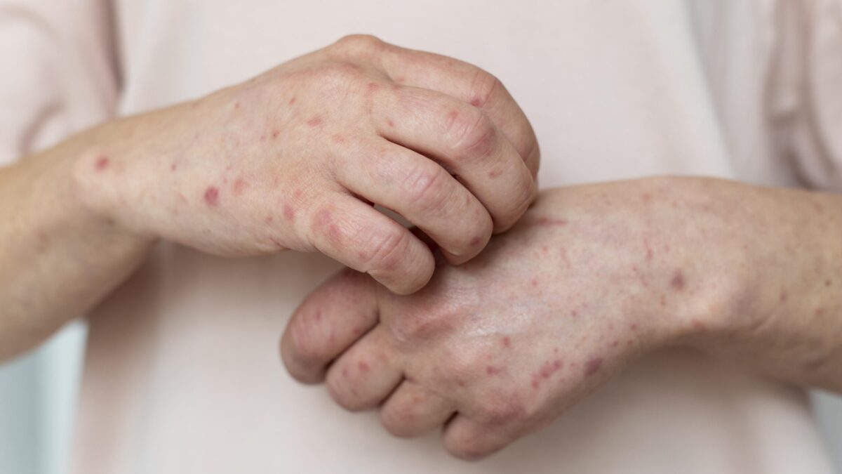 Помощь при кожных заболеваниях: список фондов