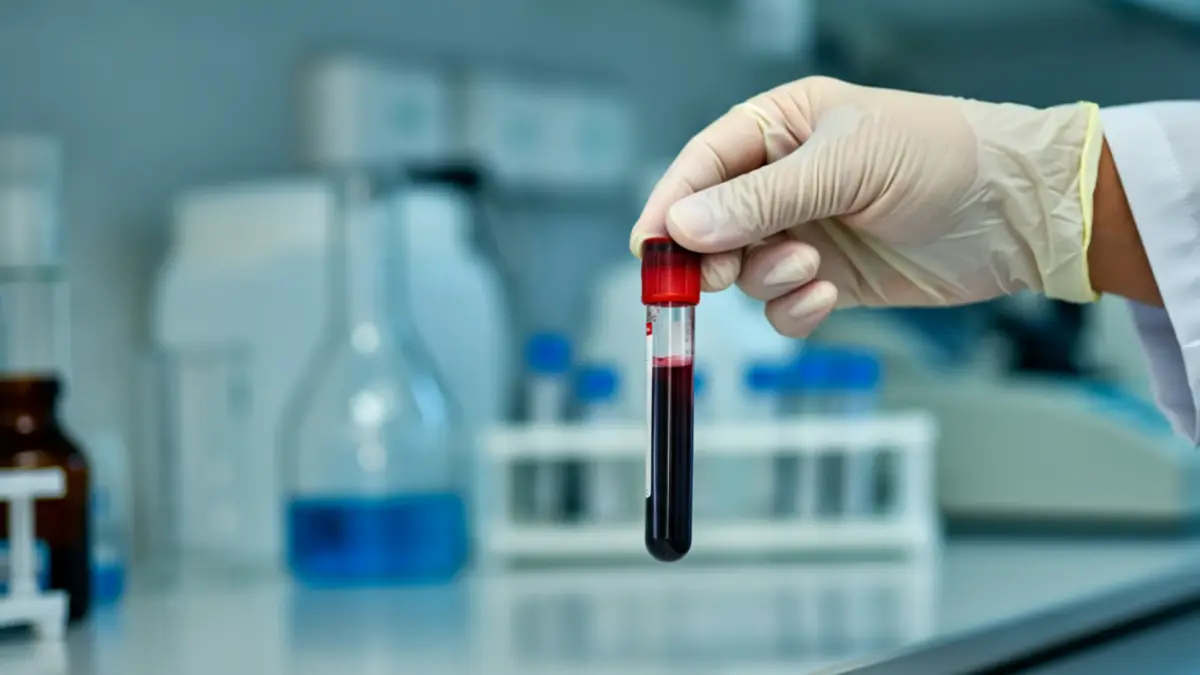 Норма сахара в крови у мужчин и женщин