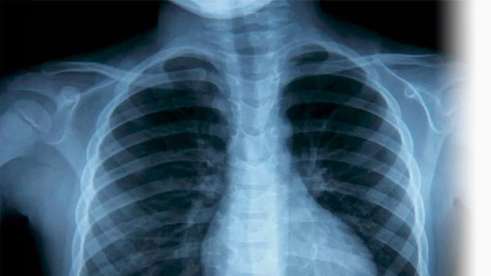 Рентгенография: когда, зачем и насколько это безопасно