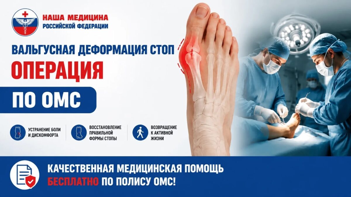 Вальгусная деформация стоп: лечение по ОМС
